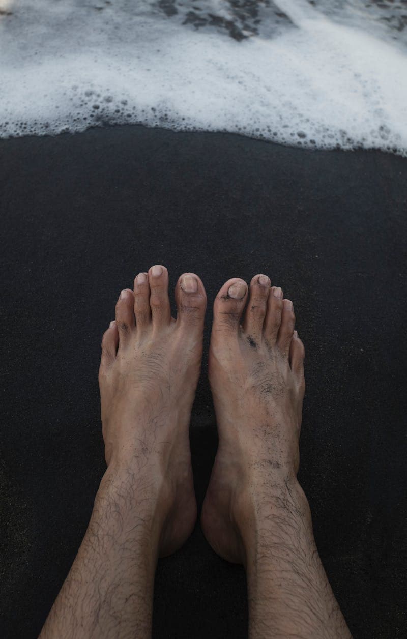 Big Toe Stiffness in Men Over 40 (Hallux Limitus and Rigidus)