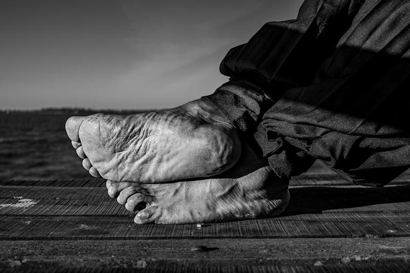 Cracked Heels: The Fix That Isn't a Pumice Stone